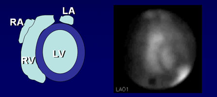 bestseptal