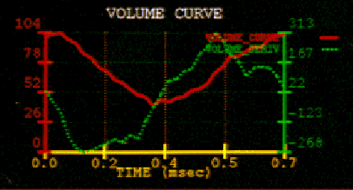 curves