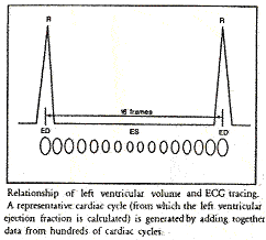 histogram1