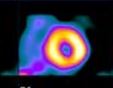 Nuclear Cardiology Seminars